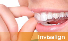 Invisalign with Text